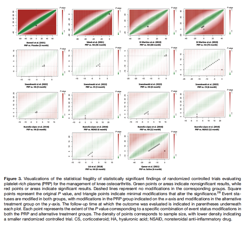 Jacob Oeding, MS (@jacoboeding) on Twitter photo What is the statistical fragility of #PRP results for knee OA? In this @AJSM_SportsMed study, we found that pooled treatment effects from RCTs comparing #PRP to alternative injection therapies were more robust than ~ half of all comparable meta-analyses in medicine. #orthotwitter What is the statistical fragility of #PRP results for knee OA? In this @AJSM_SportsMed study, we found that pooled treatment effects from RCTs comparing #PRP to alternative injection therapies were more robust than ~ half of all comparable meta-analyses in medicine. #orthotwitter