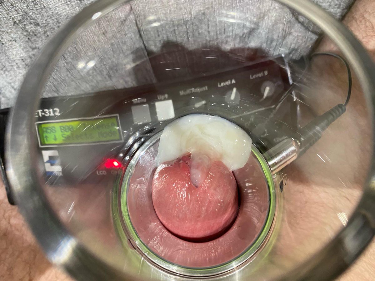 Intense #seriouskit #estim