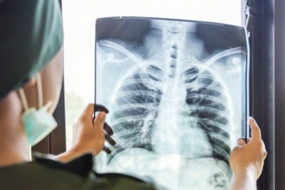 UNACToronto's tweet photo. Explore the latest #UNACTOJournal unveiling the health challenges confronting #Inuit communities. Gain insights into initiatives addressing #TB #disparities and advocating for well-being 🔗 https://t.co/6MUoFOOQvd #EndTB #HealthEquity #SDG3 https://t.co/OzmtE1E49n