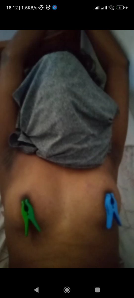 KinkyHiru's tweet photo. It was long ago and still feel the pain ahh.... https://t.co/w5KWFixx7F