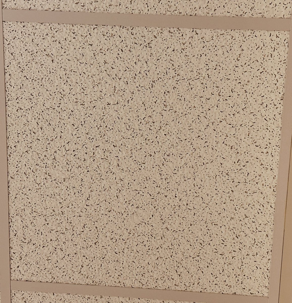 It’s been a long day of work. 

I lay down and look at the hospital ceiling. 

And I see a neurofibroma. 😄

#pathagonia #pathx #surgpath #softtissue #neurofibroma #surgicalpathology #medstudent #medx #medicine #fammed #internalmed #medical #pathtwitter