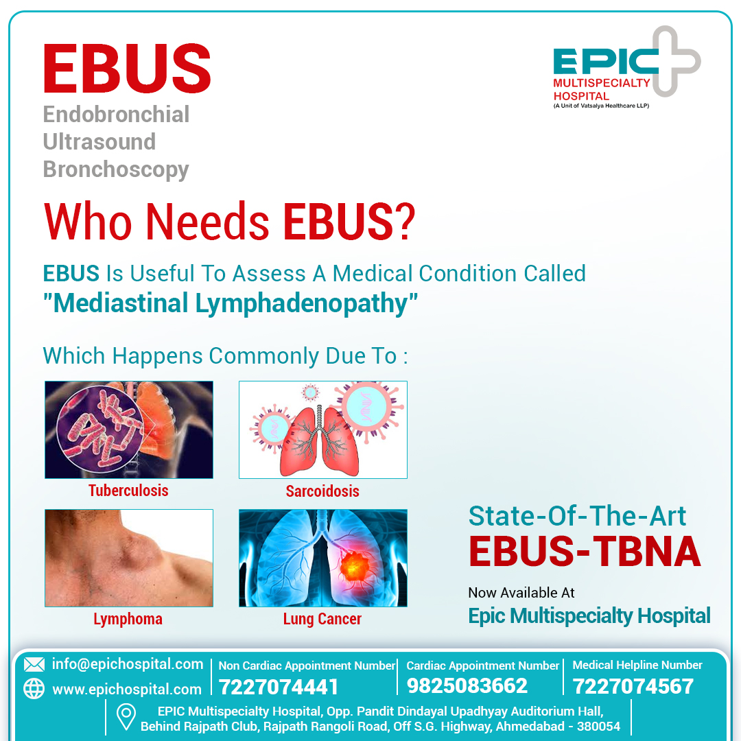 epichospital's tweet photo. EBUS is useful to assess a condition called ‘Mediastinal lymphadenopathy’’.
This happens commonly due to tuberculosis, sarcoidosis, lymphoma, or lung cancer and can help detect these ailments.
#EBUS #ebustbna #EndobronchialUltrasound #LungDisorders #pulmonology
#EpicHospital https://t.co/IXerYRxqjn