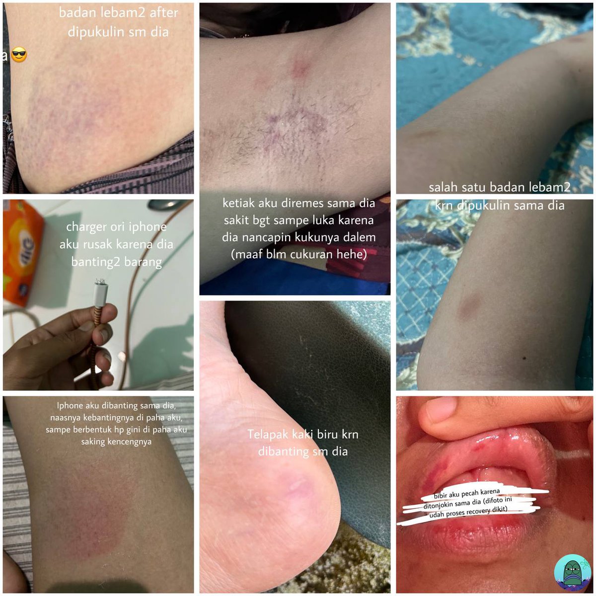 Tanyarl 💚 tweet media