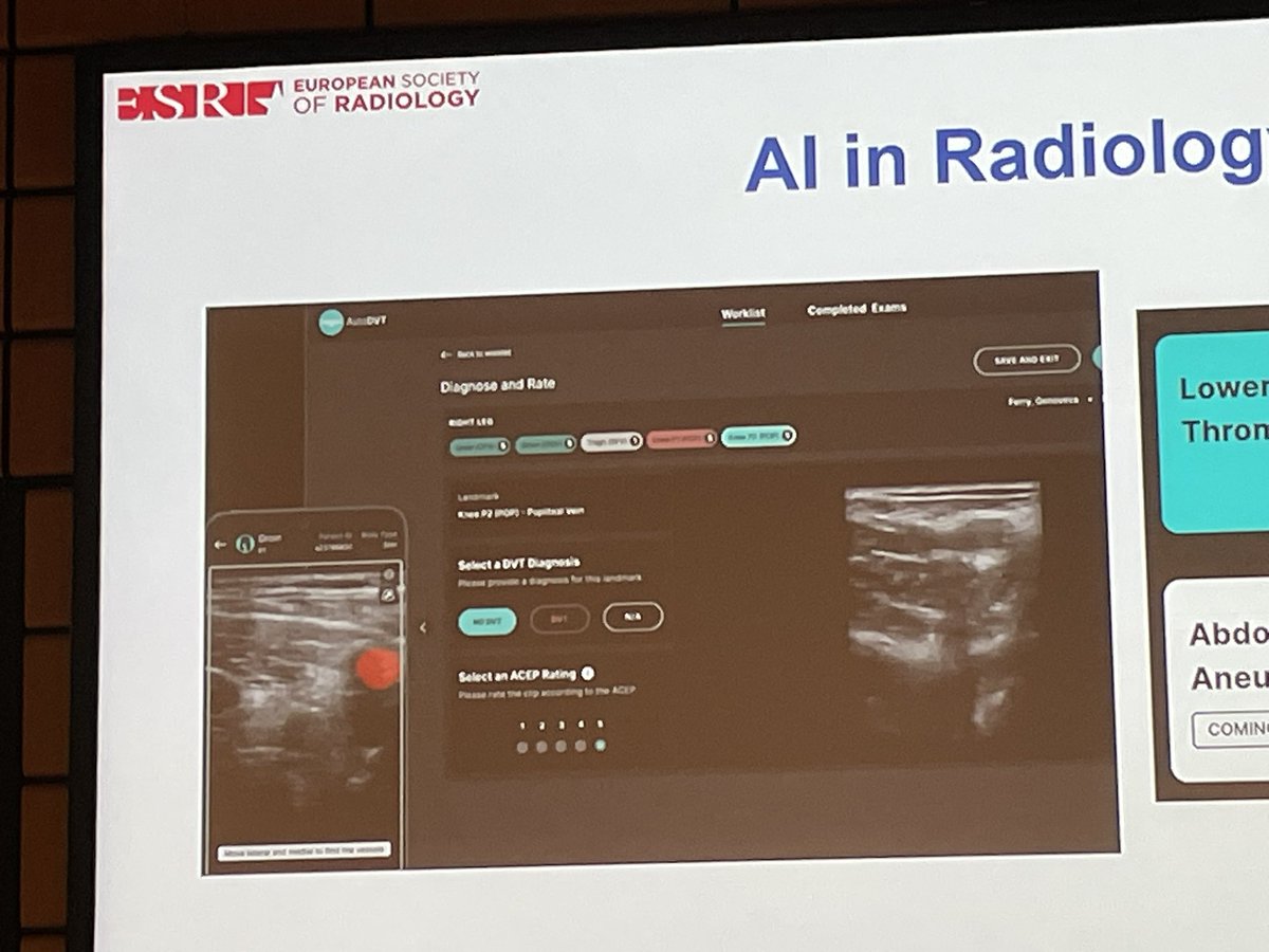 @ThinkSono at the forefront of AI in ultrasound at #ECR2024 ! 🚀