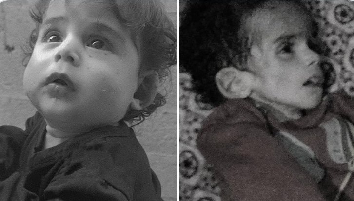 Toddler Anhar from north Gaza had puffy cheeks & bright eyes. 4.5 months of Israel assault turned him into skin & bones. He died of starvation on Tuesday. I can’t even begin to process the horror his parents may have gone through being unable to feed him. (via @muhammadshehad2)