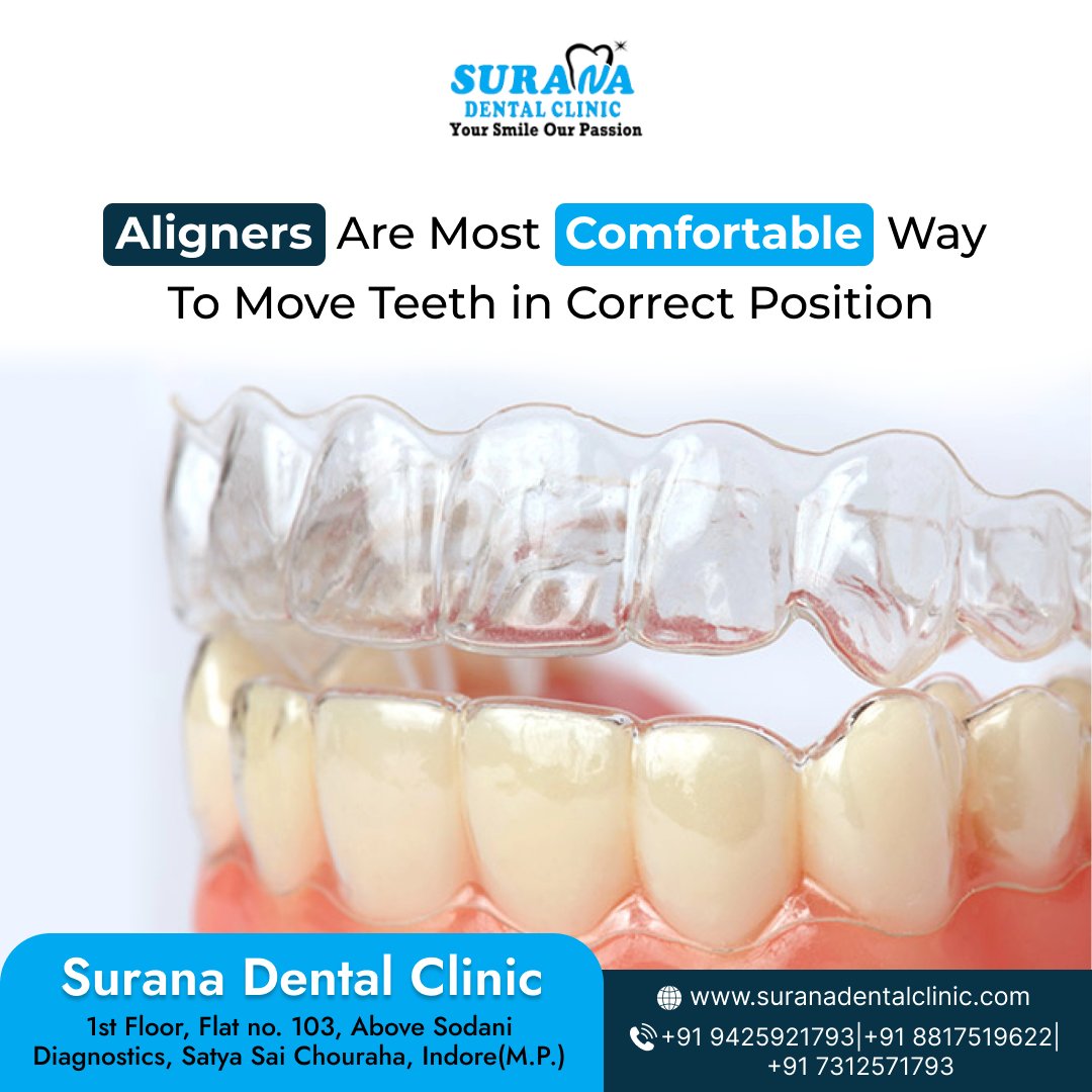 suranadental's tweet image. Aligners Are Most Comfortable Way To Move Teeth in Correct Position
.
#teethaligner #TeethAligners #teethaligners #teethalignersindia #teethalignerbraces #teethalignertreatment #healthysmiles #happyteeth #DreamSmile #brightersmile #smilemakeover #happyclient #indore