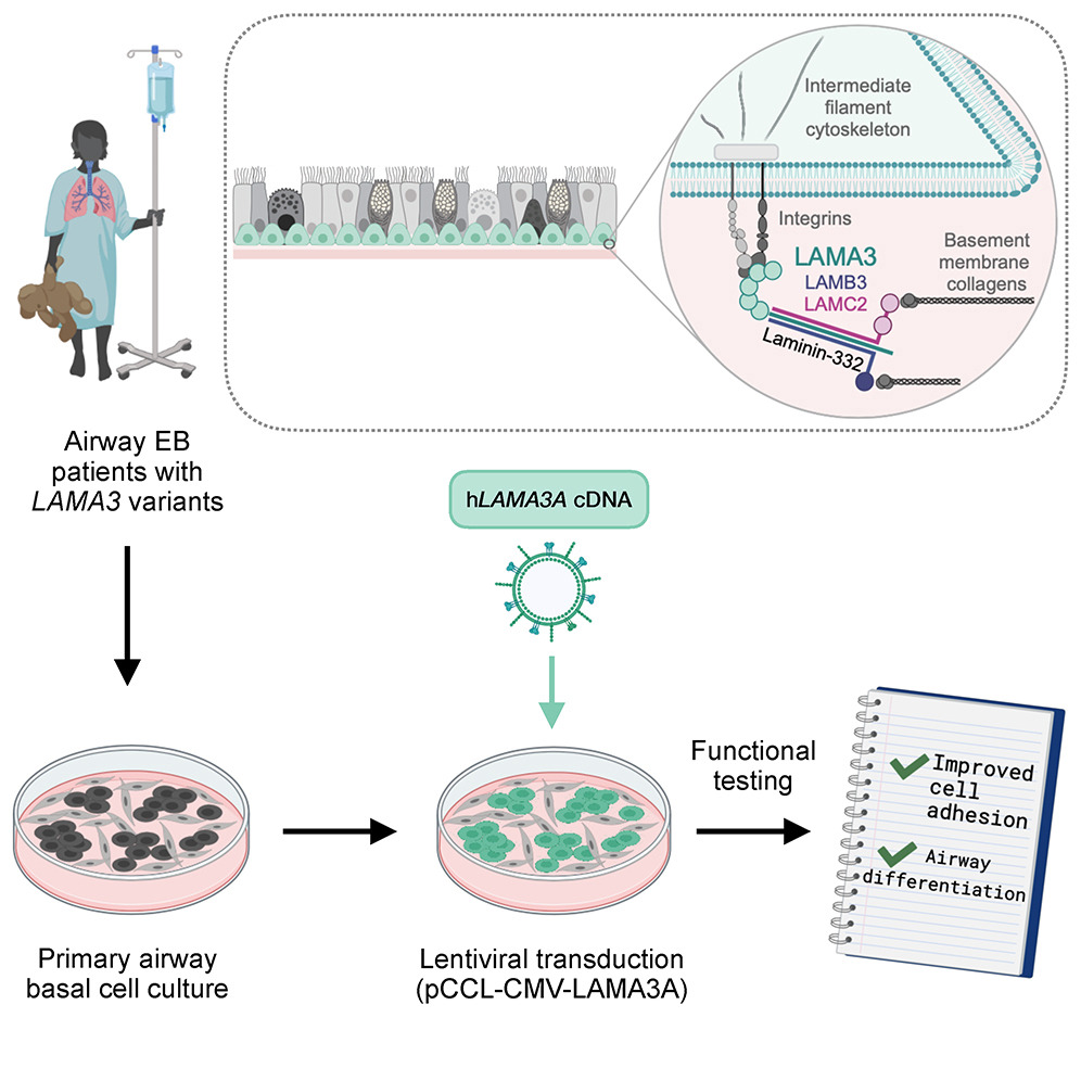 Our new paper @MolTherapy provides proof-of-concept for a combined cell and gene therapy for airway epidermolysis bullosa (EB). With colleagues @GreatOrmondSt, we investigated airway disease in EB, a group of rare genetic disorders involving defective cell adhesion 🧵... (1/8)