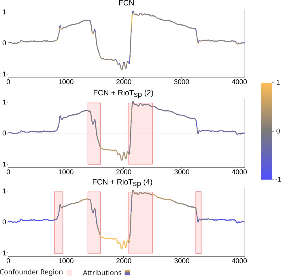 🚀 Excited to share our new work! Tackling time series confounders with RioT:

🔄 Feedback across time &amp; frequency
🎯 Steers models to right reasons
📊 Tested on our novel production line dataset with natural confounding factors

arxiv.org/abs/2402.12921
huggingface.co/datasets/AIML-…