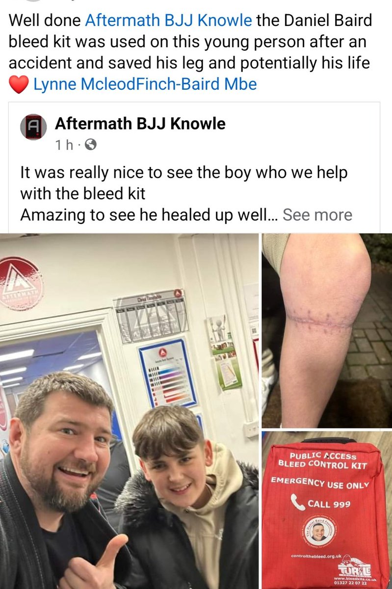 How wonderful to see that @TheDanielBaird1 kit was used to help this young lad in #Bristol. Well done everyone 👏👏 @hollybaird_x @stanchers @IanGreenWMP @FigenMurray @kerry_baird @samatquinton @cummins23 @KeiranCasey @RaeRae99 @smcgrath90 @ScarcityStudios @lettheyouthlive