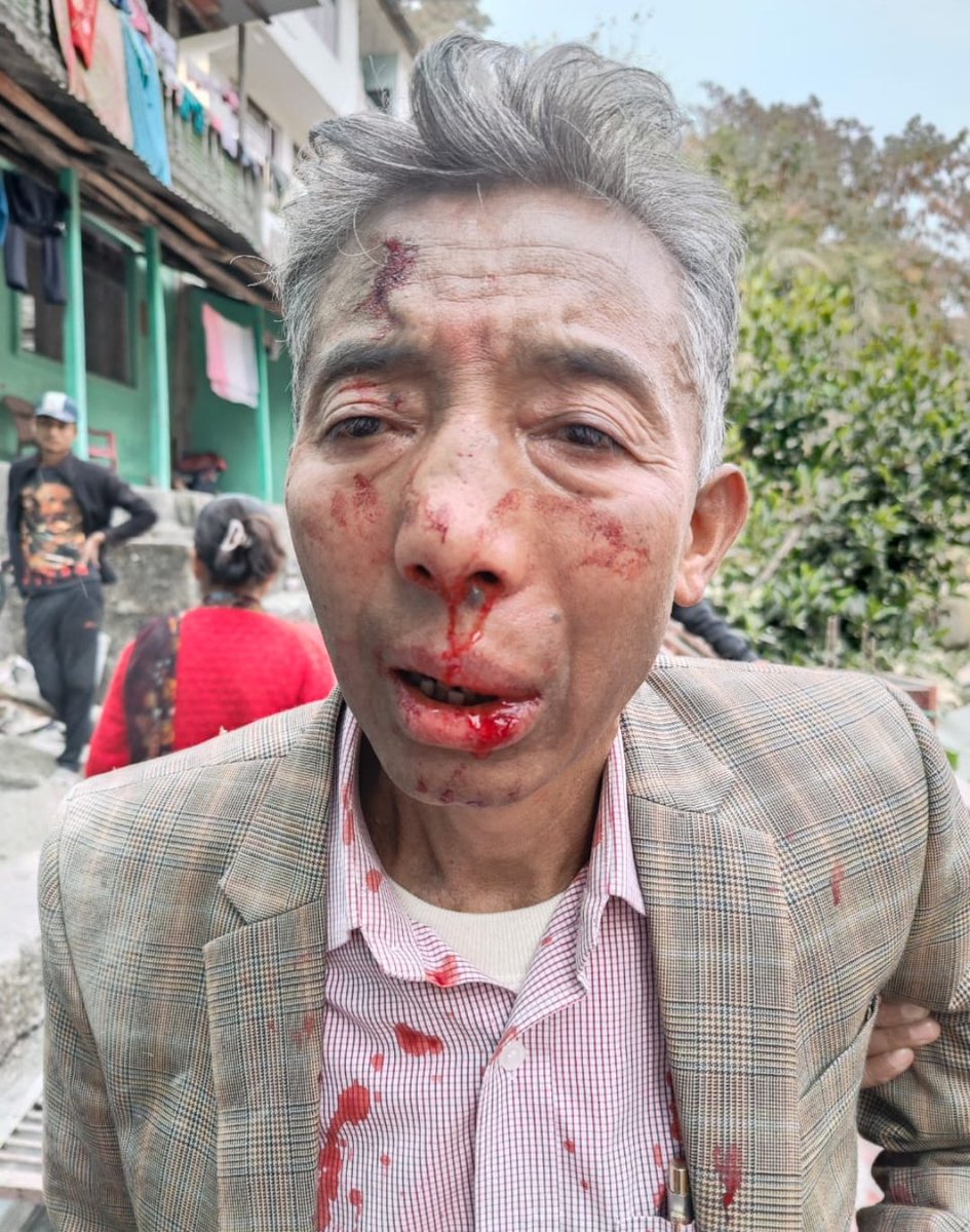 Frm speaker of Sikkim mr KN Rai was brutally attacked by illegal and corrupt CM PS Golay's Goons. my beautiful and peaceful Sikkim under mr Golay has gone through major law and order failure in last 5 yrs. 
<a href="/narendramodi/">Narendra Modi</a> <a href="/AmitShah/">Amit Shah</a> <a href="/ECISVEEP/">Election Commission of India</a>  pls seriously look into mr Golay's