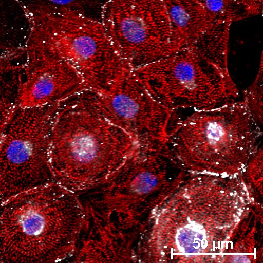 Researchers @McEwenInstitute explore the potential of stem cell-derived cardiomyocytes for heart repair. Their findings illuminate critical paths toward the use of stem cell therapies for #cardiovascular health. #StemCellResearch > uhnresearch.ca/news/unlocking…; doi.org/10.3390/biom14…