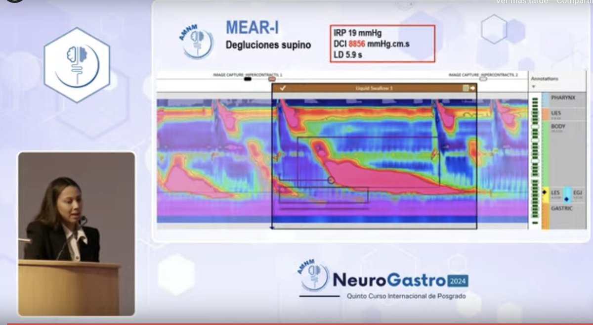 NeuroGastro2024, aprendiendo de los mejores <a href="/ElianaMorel7/">Eliana Morel</a>