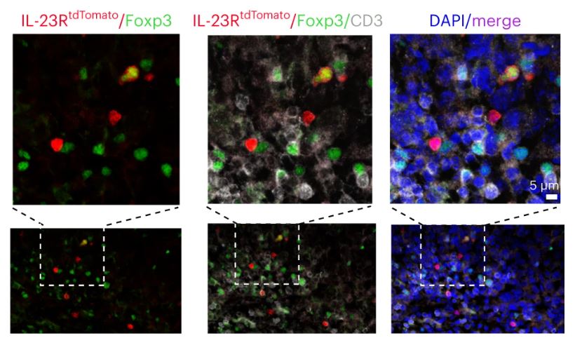 Immunology Podcast (@immunopodcast) on Twitter photo How does IL-23 fuel tumor growth?
Drs. Tobias Wertheimer (<a href="/WertheimerT/">Tobias Wertheimer</a>), <a href="/PascaleZwicky/">Pascale Zwicky</a>, and a team in Drs. Sonia Tugues' and Burkhard Becher's (@BecherLab) labs found that IL-23 stabilizes #Treg identity.
📑 <a href="/NatImmunol/">Nature Immunology</a>: go.nature.com/3v0YohX
🎙️: bit.ly/3ImFmFK How does IL-23 fuel tumor growth?
Drs. Tobias Wertheimer (<a href="/WertheimerT/">Tobias Wertheimer</a>), <a href="/PascaleZwicky/">Pascale Zwicky</a>, and a team in Drs. Sonia Tugues' and Burkhard Becher's (@BecherLab) labs found that IL-23 stabilizes #Treg identity.
📑 <a href="/NatImmunol/">Nature Immunology</a>: go.nature.com/3v0YohX
🎙️: bit.ly/3ImFmFK