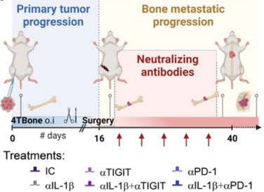 Elizabeth McKenna (@elizsmckenna) on Twitter photo Now online in <a href="/CD_AACR/">Cancer Discovery</a>: Combining #TIGIT Blockage with MDSC Inhibition Hinders #BreastCancer Bone Metastasis by Activating Anti-tumor Immunity <a href="/LMonteran/">Lea Monteran</a> <a href="/ErezNeta/">Neta Erez- ErezLabšļø</a> doi.org/10.1158/2159-8⦠<a href="/TelAvivUni/">Tel Aviv University</a> Now online in <a href="/CD_AACR/">Cancer Discovery</a>: Combining #TIGIT Blockage with MDSC Inhibition Hinders #BreastCancer Bone Metastasis by Activating Anti-tumor Immunity <a href="/LMonteran/">Lea Monteran</a> <a href="/ErezNeta/">Neta Erez- ErezLabšļø</a> doi.org/10.1158/2159-8⦠<a href="/TelAvivUni/">Tel Aviv University</a>