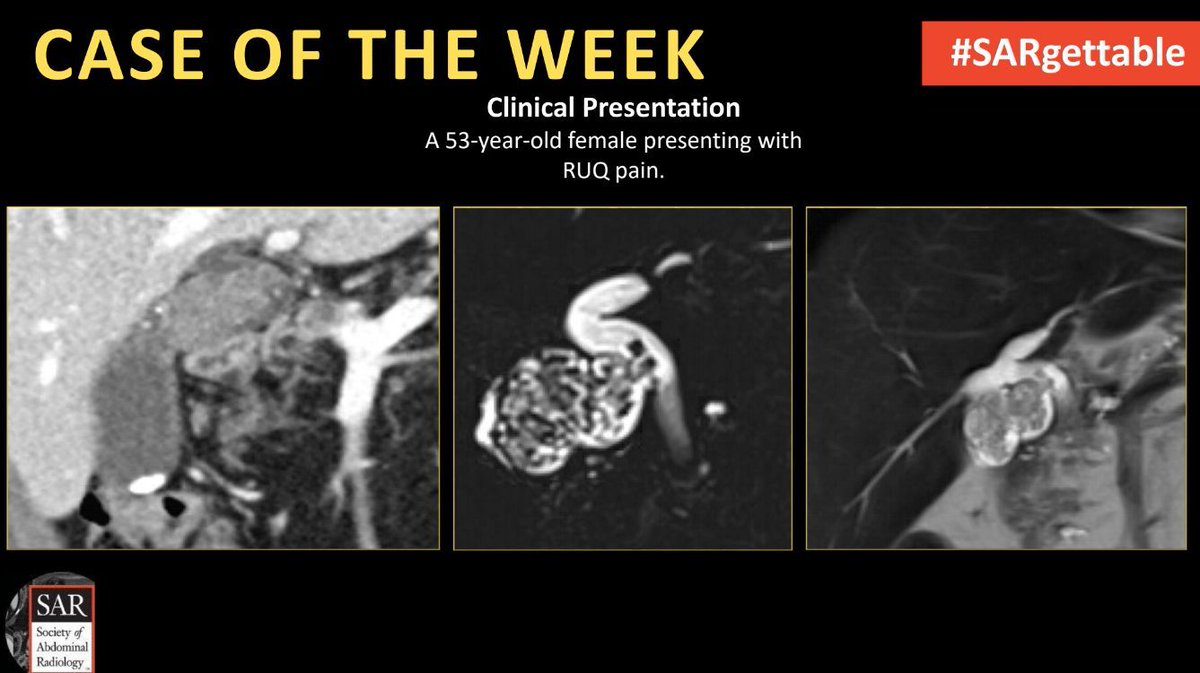 It's time for a new #SARgettable case of the week contributed by @AndreaEsqXR. Comment with your diagnosis down below!