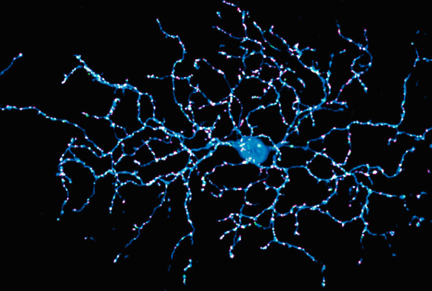 A retinal neuron (blue) connects with many neighboring neurons, with proteins at these connections glowing magenta and green. Credits: Sigal Y.M. et al. #MedTwitter #neuroscience