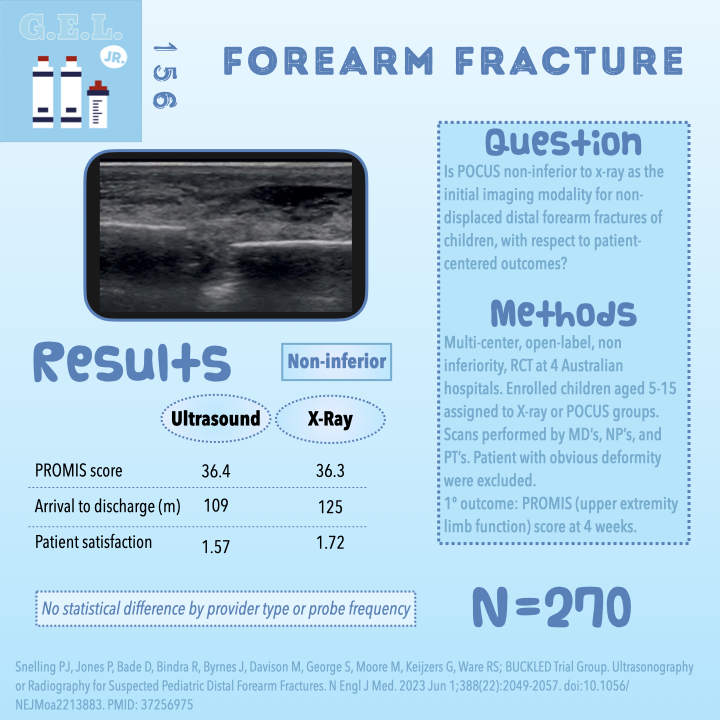 #GELJr team with a great ep on #POCUS in pediatric forearm fractures! Nice review and pointers about a high quality study! #USGEL #PEM @DGoodAsGold @doctorlianne @RussUltrasound @PratsEM ultrasoundgel.org/posts/CBmnmvRE…