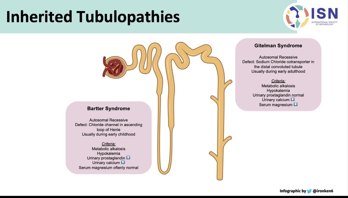 🦻Have you heard of Acquired Bartter syndrome 🙇‍♀️

👇Have a look 

@ISNeducation @ISNkidneycare #ECNeph