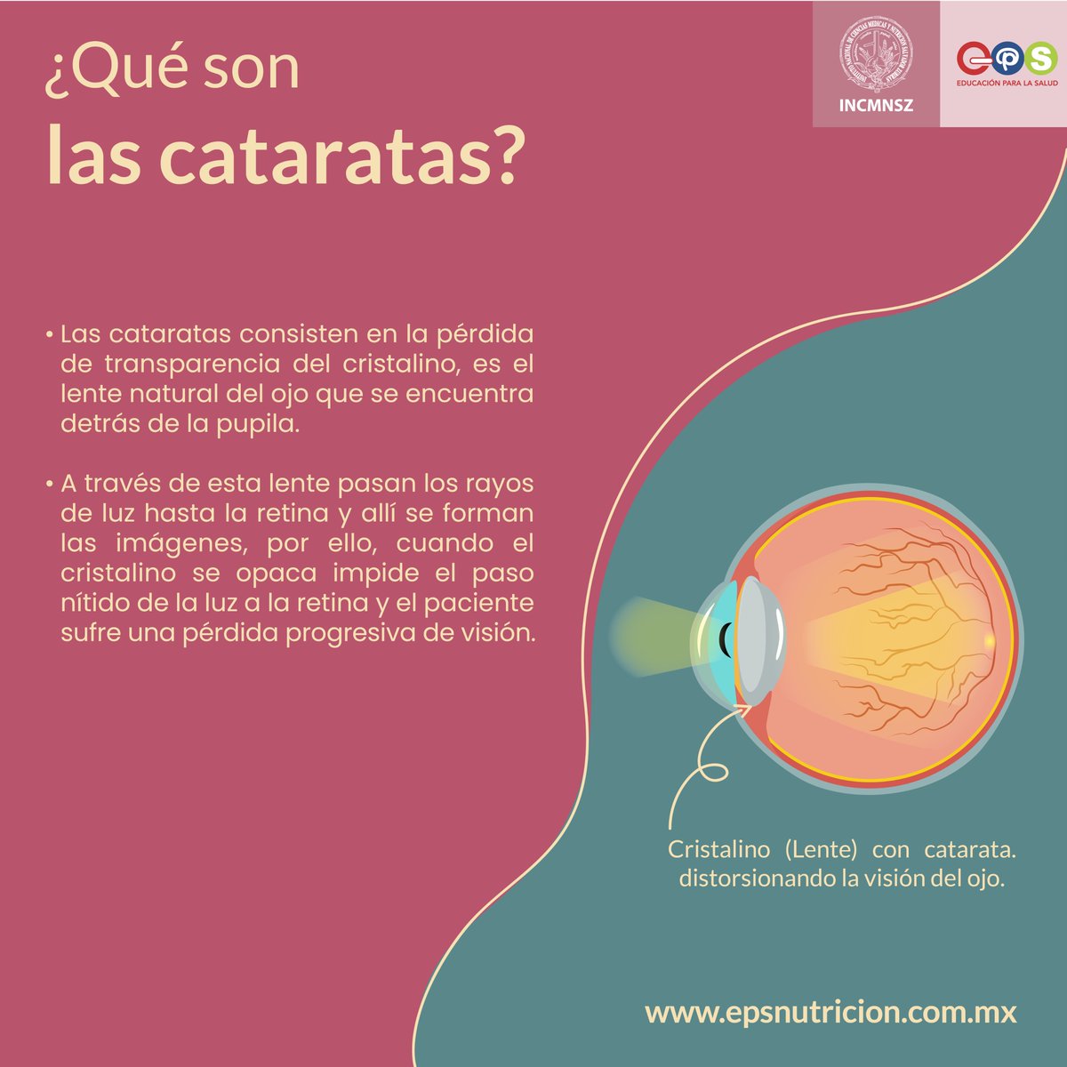 INCMNSZ_EPS's tweet image. #CataratasEnLosOjos | Instituto Nacional de Ciencias Médicas y Nutrición Salvador Zubirán

#Cataratas #SaludOftalmologica #CuideSusOjos #SaludOcular #ProblemasDeVisión #SaludVisual #Cristalino #Oftalmólogo #EPS #INCMNSZ