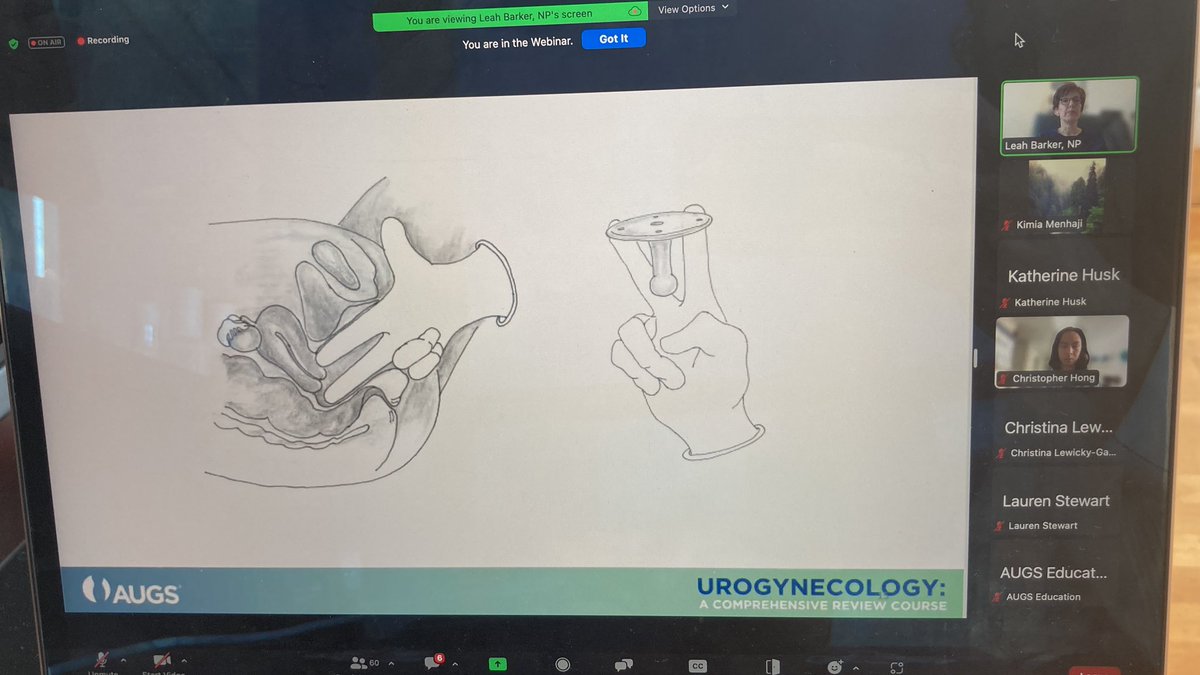 kmenhaji_md's tweet image. What tricks do you have for #pessary fitting?

Dr. @ChrisHongMD and Leah Barker, NP discuss all things #pessaries!

@urogynsociety Comprehensive Review Course Day2!!