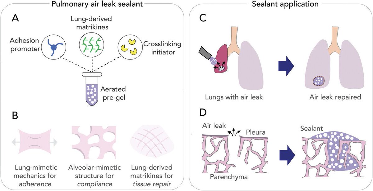 Our new paper on a 'Lung-Mimetic Hydrofoam Sealant to Treat Pulmonary Air Leak' is now published in Advanced Healthcare Materials @AdvSciNews! Congratulations to project leads @meghanpinezich, Mohammad Mir, & team on this great work!