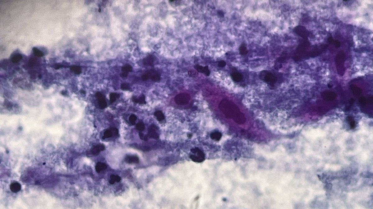 MonicaModesto's tweet photo. #cytogyn https://t.co/Q2ufAdcnZo
