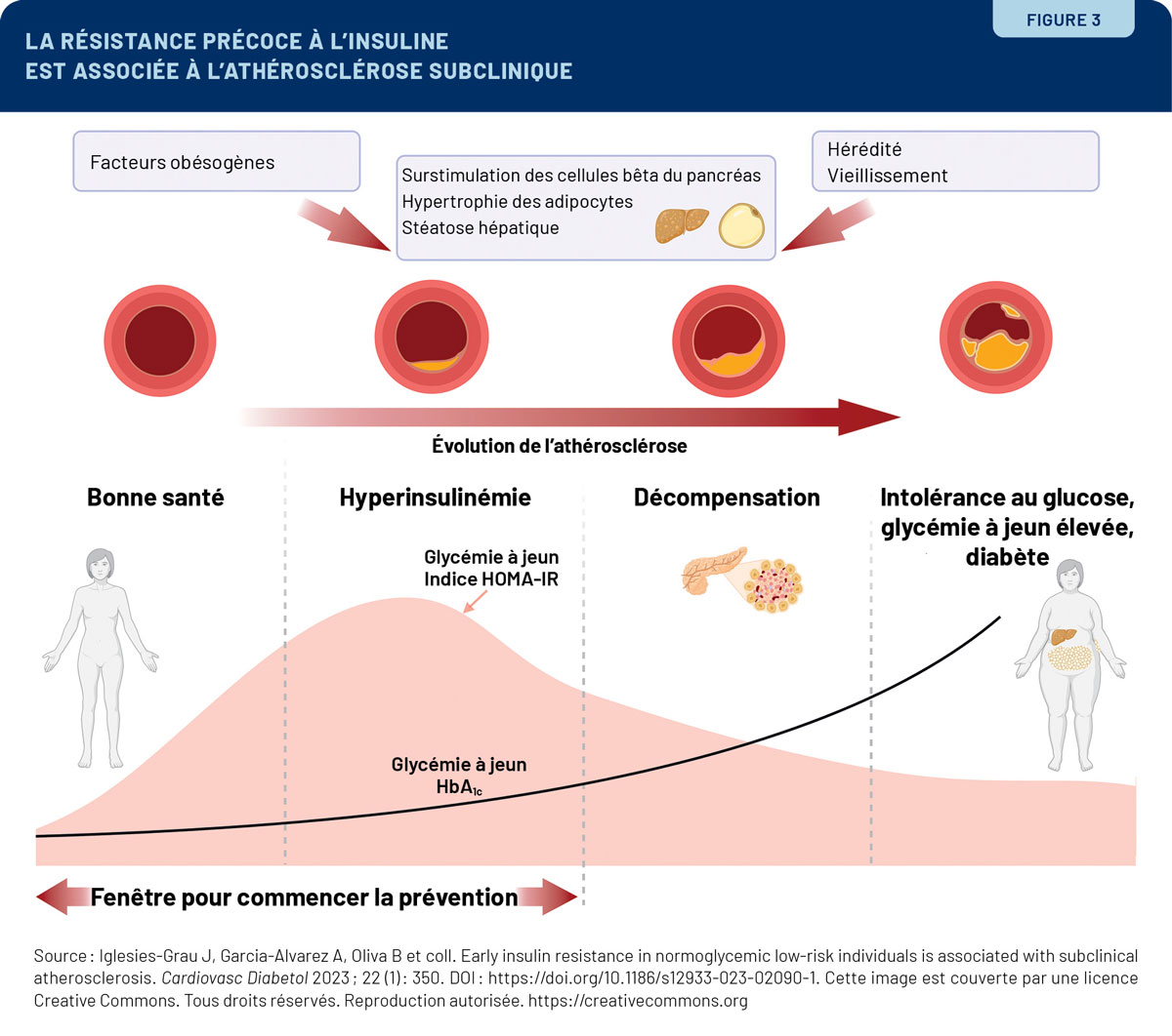Insulinémie à jeun chez les individus normoglycémiques: un indicateur potentiel d'athérosclérose subclinique, et une opportunité d'intervention le plus tôt possible !

Article apparu aujourd'hui dans la revue Médecin du Québec. 

lemedecinduquebec.org/archives/2024/…