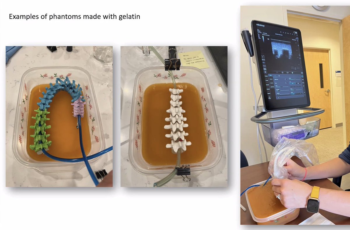 Check out this awesome LP model! #POCUS #neoPOCUS. It's not too late to join this great session!