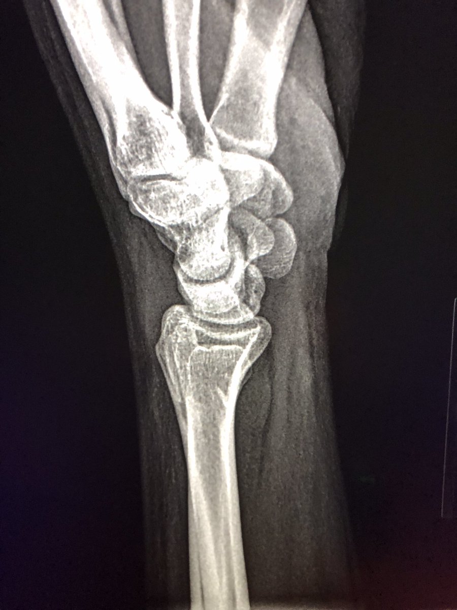 bacole26's tweet photo. Dog bite https://t.co/6y2FcTJW8l