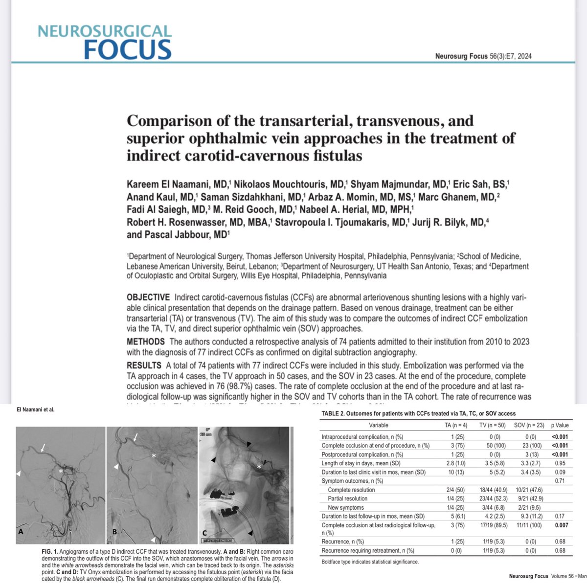 Pascal Jabbour MD, FAANS, FACS, FAHA (@pascaljabbourmd) on Twitter photo Just published in <a href="/JNSPG_EIC/">EIC of the JNSPG</a> our series of indirect CCFs ( Type B,C,D) through different routes TA, TV, SOV :
1- 77 cases , 71 treated only with Onyx
2- Occlusion rate 100% in TV and SOV and 75% in TA
3- Recurrence rate 0% SOV, 5.3% TV, 25% TA
Put together by <a href="/KareemNaamaniMD/">Kareem M. El Naamani, MD</a> Just published in <a href="/JNSPG_EIC/">EIC of the JNSPG</a> our series of indirect CCFs ( Type B,C,D) through different routes TA, TV, SOV :
1- 77 cases , 71 treated only with Onyx
2- Occlusion rate 100% in TV and SOV and 75% in TA
3- Recurrence rate 0% SOV, 5.3% TV, 25% TA
Put together by <a href="/KareemNaamaniMD/">Kareem M. El Naamani, MD</a>