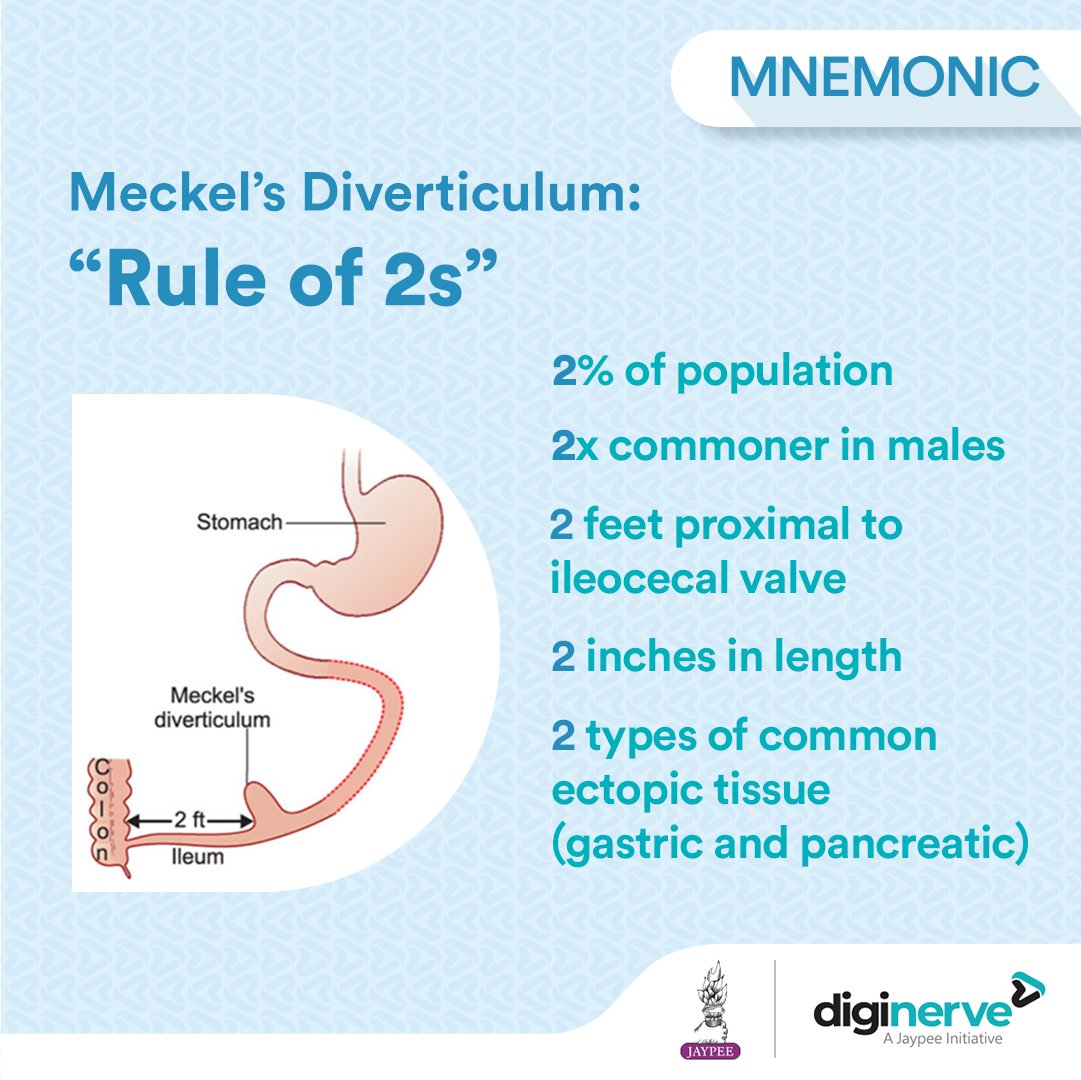 Meckel’s Diverticulum follows Rule of 2s in Clinics.

#DigiNerve #MedicalStudents #MedicalStudies #MBBS #Mnemonic #MeckelsDiverticulum #RuleOf2s #MDAwareness #GastrointestinalHealth #PediatricSurgery #RareConditions #CongenitalAnomalies #SmallIntestineDisorders