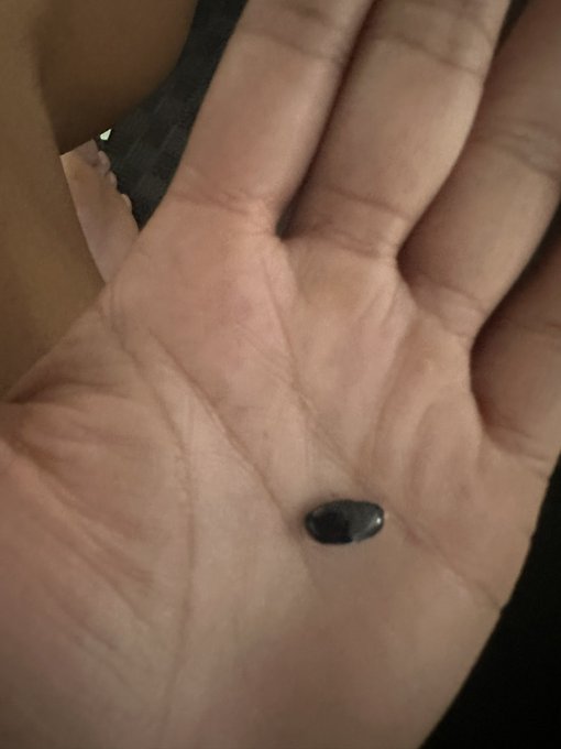 I lost a toe nail after my run today.   🥹 https://t.co/raOTmUoCnS