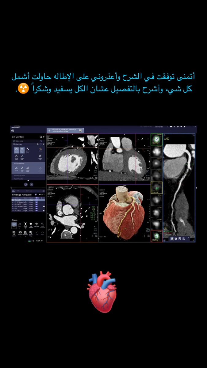 السلام عليكم ، فيه ثريد تعبت عليه جداً بخصوص corCTA، بأرتبه وأنزله لكم هنا ان شاء الله، طبعاً الثريد قد نزل بسنابي👌🏻☢️.  

t.snapchat.com/toOe3UJn