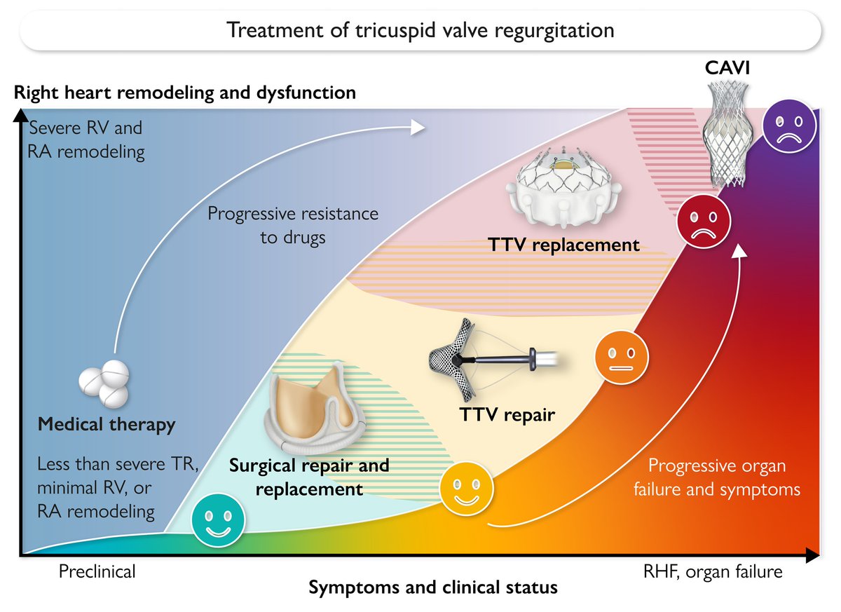 Transcatheter treatment of the tricuspid valve: current status and perspectives. A State-of-the-Art Review just published in #EHJ @escardio @ESC_Journals #CardioTwitter @drmaisano @PhilippLurz academic.oup.com/eurheartj/adva…