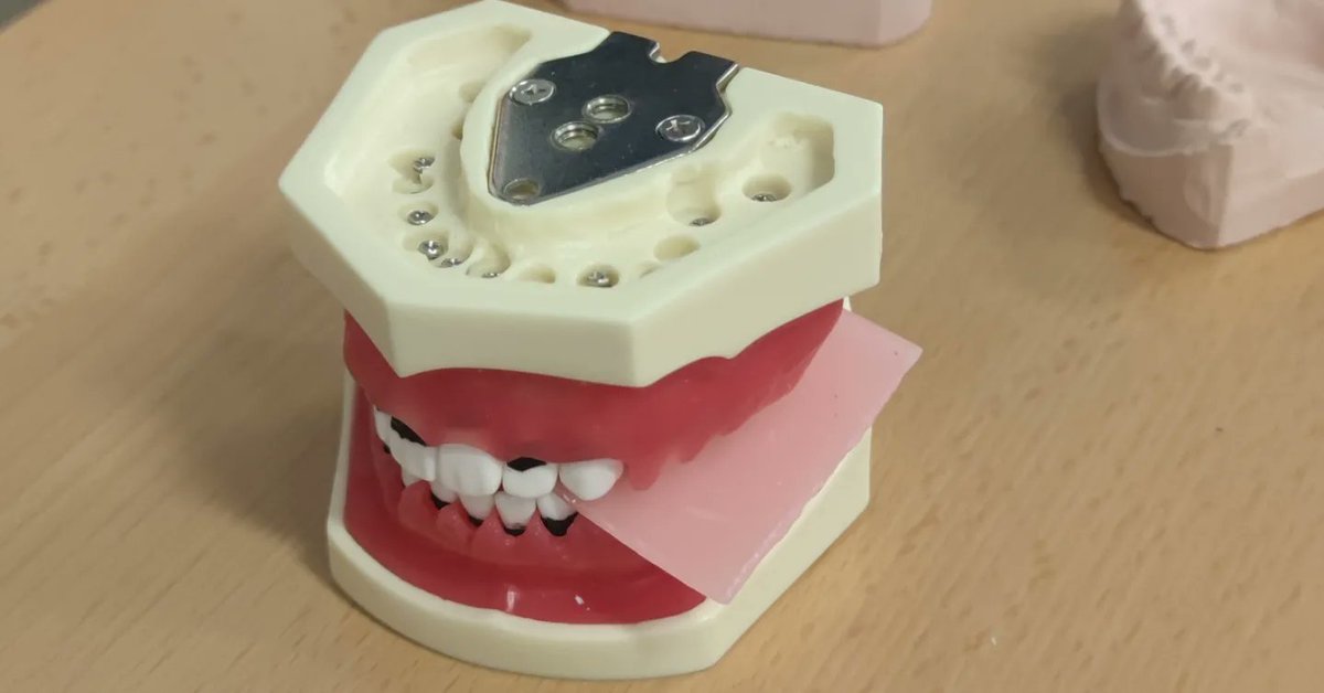 SAFAAlcala's tweet image. 📣 TALLER IMPRESIONES DENTALES #EnFPSAFA #FormaciónComplementaria #Odontología 🦷😁‼️

➡️ El alumnado de CAE ha complementado su formación con un taller sobre la realización de impresiones dentales, vaciado correspondiente y registro de mordida dental 👏👏👏