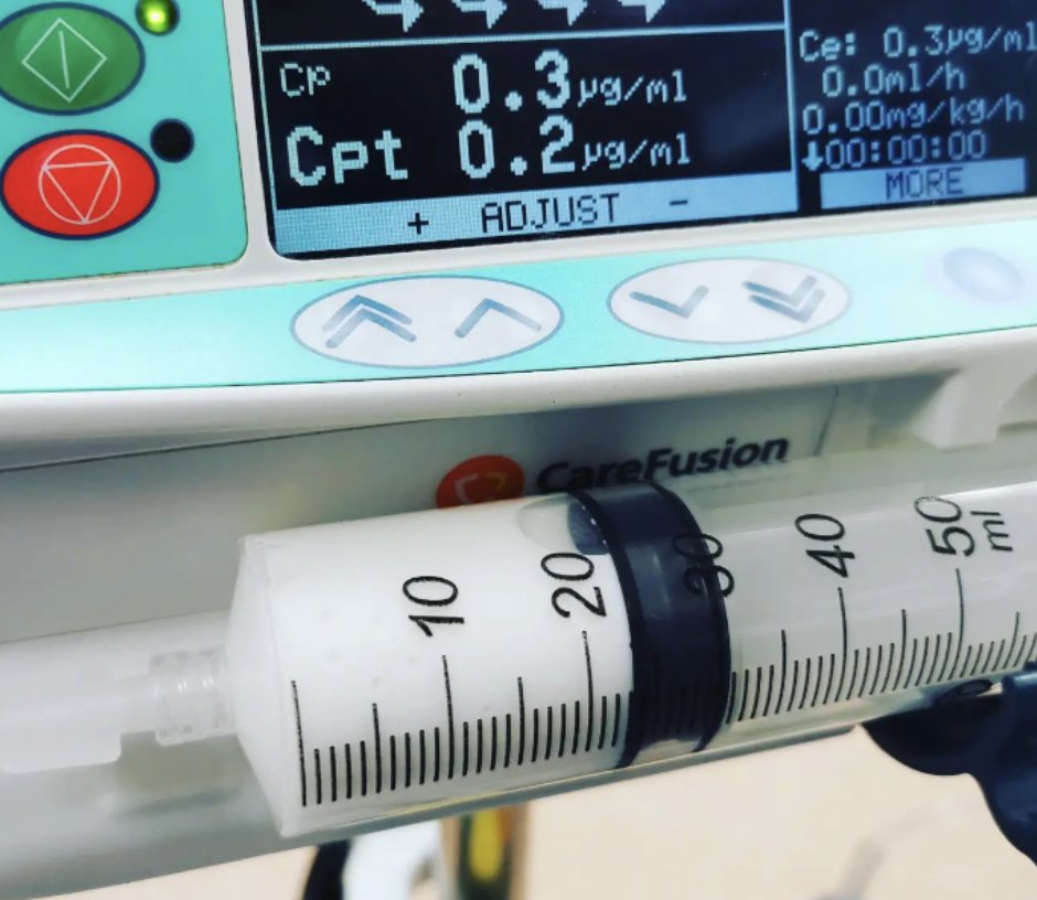 Total intravenous anaesthesia for caesarean delivery (CD): tertiary unit case series (n=20) 💉Used in limited non emergency CDs 💉1 case of awareness due to “tissued” IV cannula 💉Further research required @kcbanaesthesia #ObAnes #ObAnaes #tiva obstetanesthesia.com/article/S0959-…