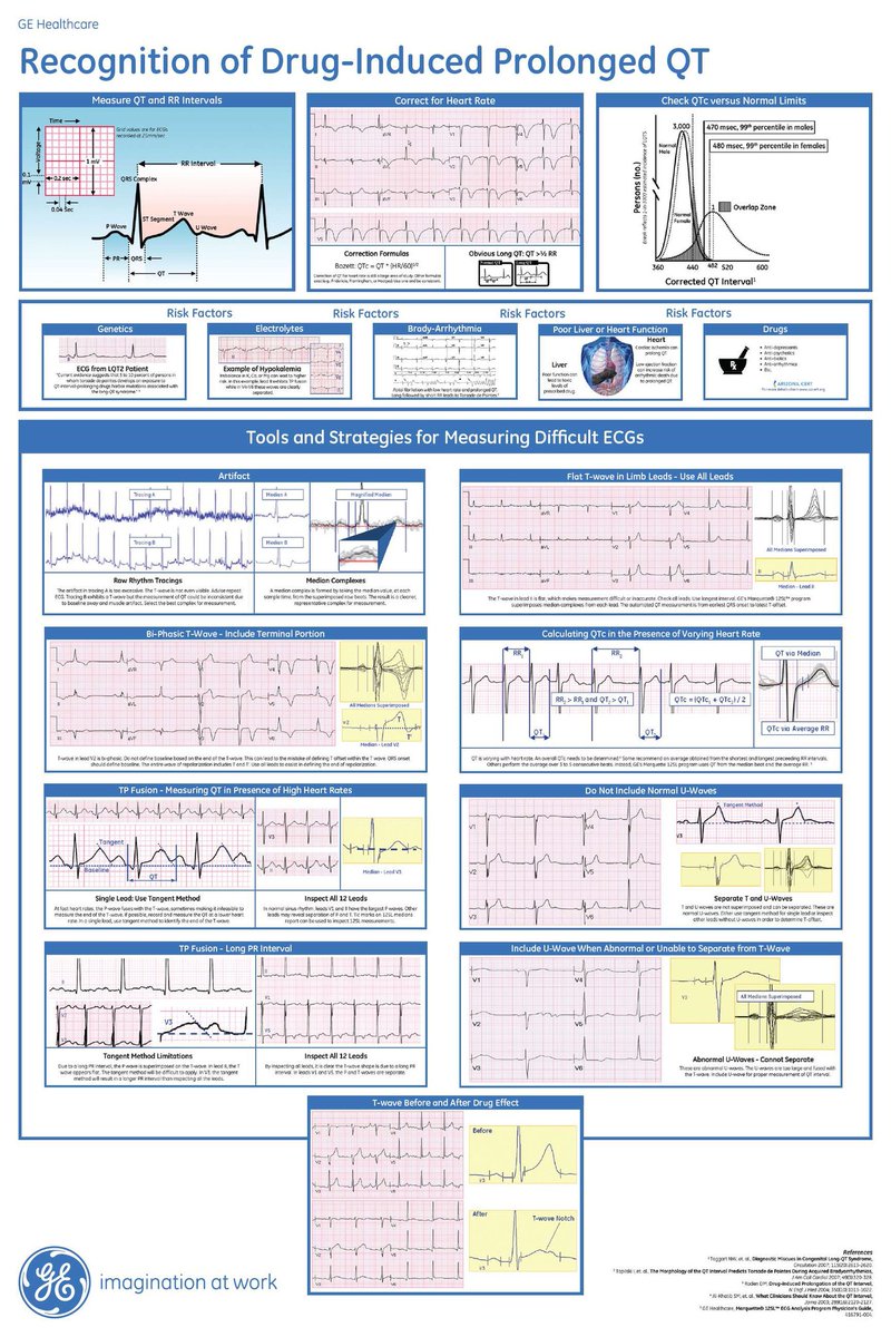 🔴 Cardiotoxicity &amp; Drug Therapies: How #ECG Can Help👏🏻✨

  💥Recognition of Drug -Induced Prologed QT 
gehealthcare.com/insights/artic…
#cardiology #cardiotwitter #cardiox #medicine #MedEd #medical #ECG #EKG