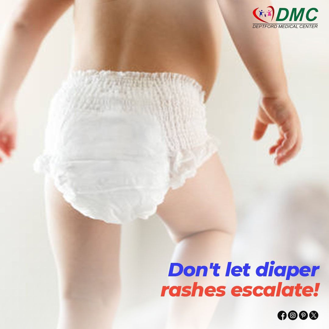 A quick checkup at our Ultra Care Clinic can identify fungal infections or eczema in children. Walk in for immediate attention.

Call us at (856) 848-8060
#DMC #health #care #healthylifestyle #ultracare #diaperrashes #fungalinfections #checkup #childern #eczema #clinic #saturday