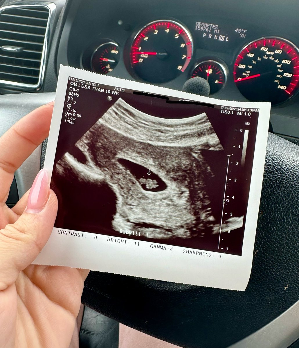 My Rainbow Baby 🥺🌈