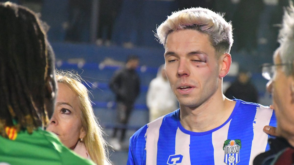 Brutal agressió a un jugador del Cassà després del partit contra el Cristinenc dlvr.it/T3WzQ4