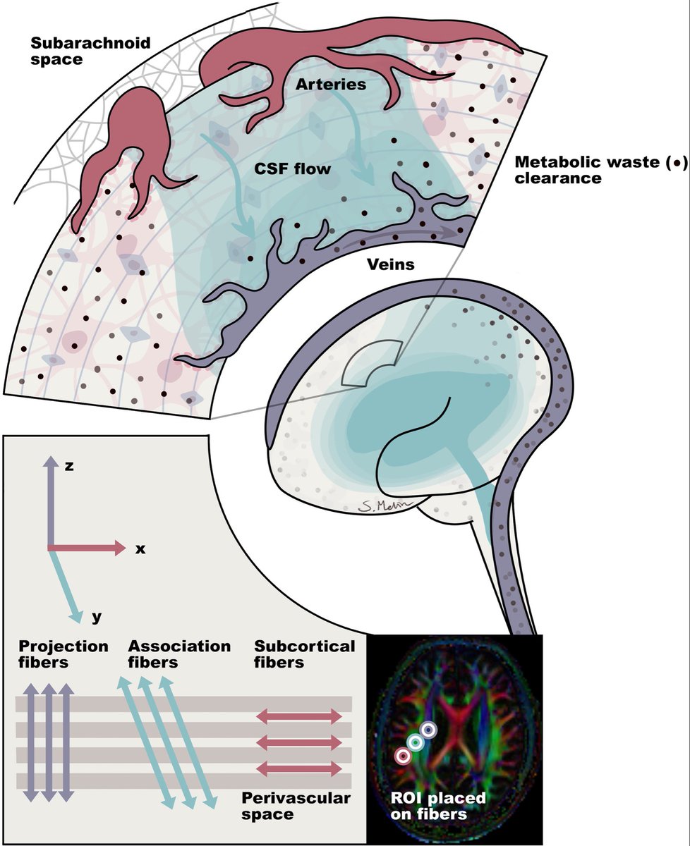 What are glymphatics anyway? Well, find out here in March issue of @TheJNS ! Free article: thejns.org/view/journals/…