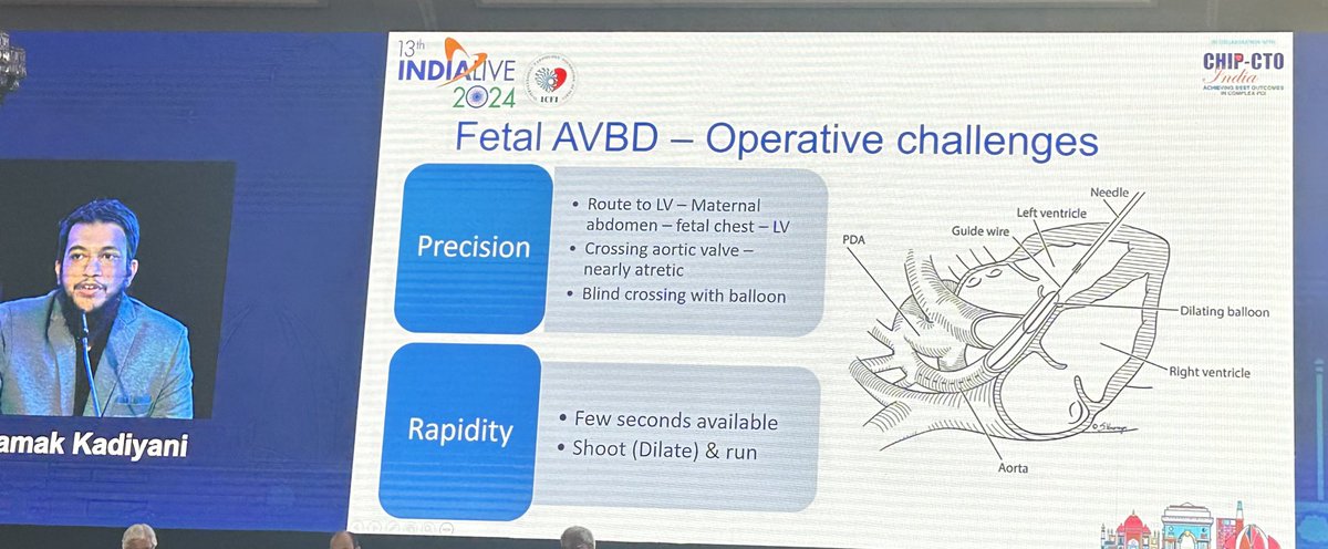 Best Case Award of 6000$, #IndiaLive2024 goes to Dr Lamak Kadiyani of AIIMS New Delhi, for Fetal Aortic Balloon Valvuloplast case, in a 28yF with multiple previous fetal losses. Child is now 1 yr old. @Hragy @Zill_cardio @ziadalinyc @purviparwani @ShariqShamimMD