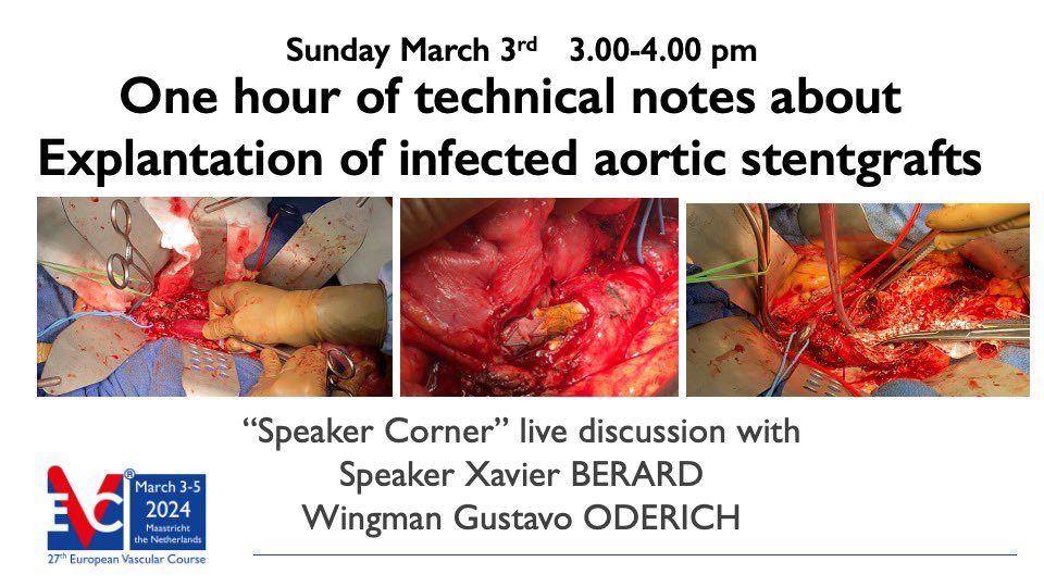 Xavier Berard (@xavierberardmd) on Twitter photo One hour technical notes live discussion with <a href="/GustavoOderich/">Gustavo Oderich</a> about infected aortic stent graft explantations.
#aortaEd at #EVC2024 In Maastricht Netherlands One hour technical notes live discussion with <a href="/GustavoOderich/">Gustavo Oderich</a> about infected aortic stent graft explantations.
#aortaEd at #EVC2024 In Maastricht Netherlands