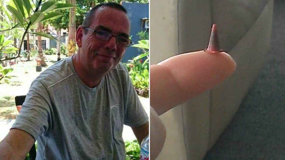 creepydotorg's tweet photo. A man who thought he was suffering from lung cancer underwent urgent surgery to remove a cancerous growth in his lungs. The surgeons discovered the man did not have lung cancer, the ‘growth' was actually just a toy traffic cone he inhaled 40 years ago. https://t.co/rKWDaBbyCT