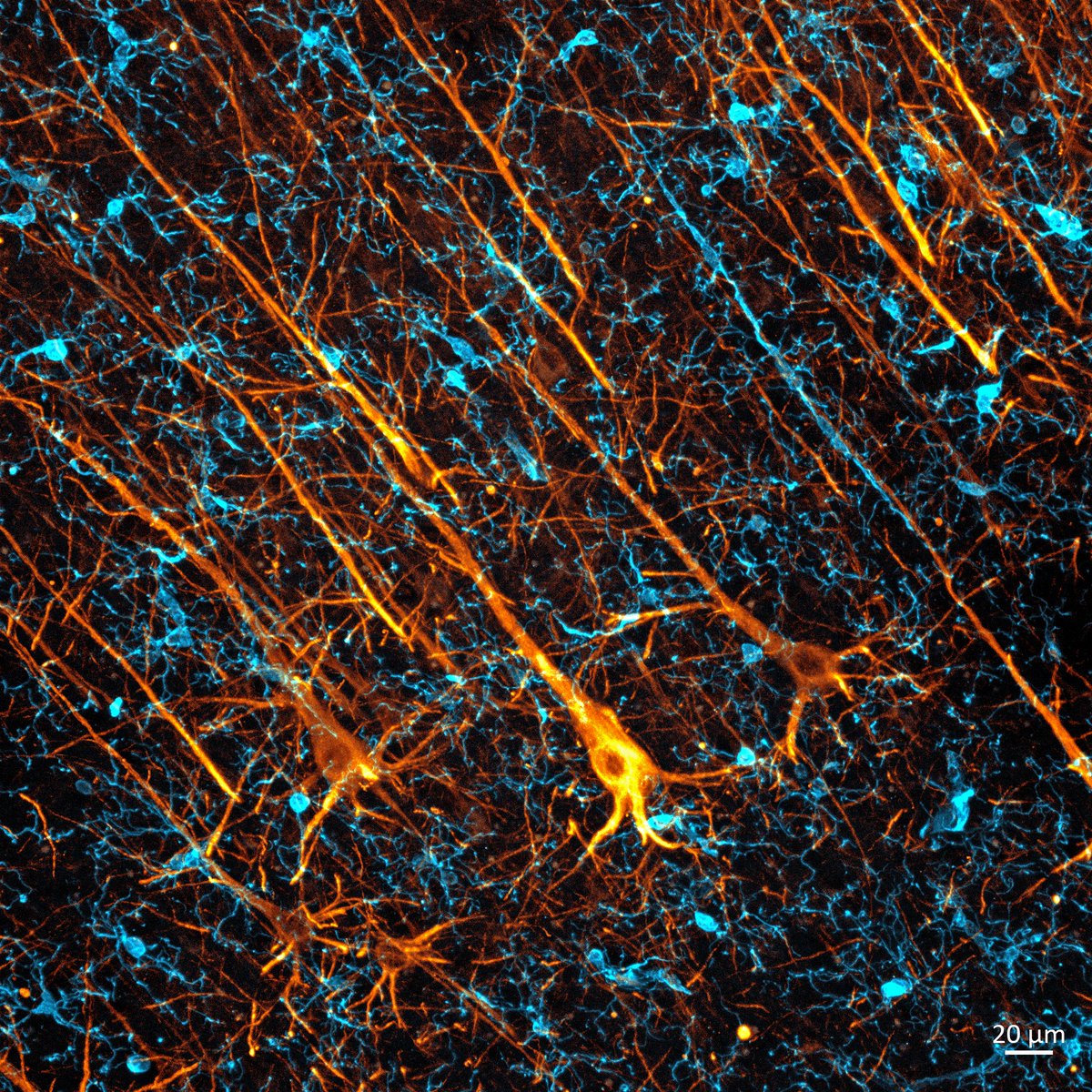Neurons (🟠) and microglia (🔵), brain's immune cells! Check the number of microglia available for each neuron. That's because this photo was taken in the cerebral cortex 🧠🔬.
In humans, the glia-to-neuron ratio in the cerebral cortex is 3.72 (72% glia), while that in the