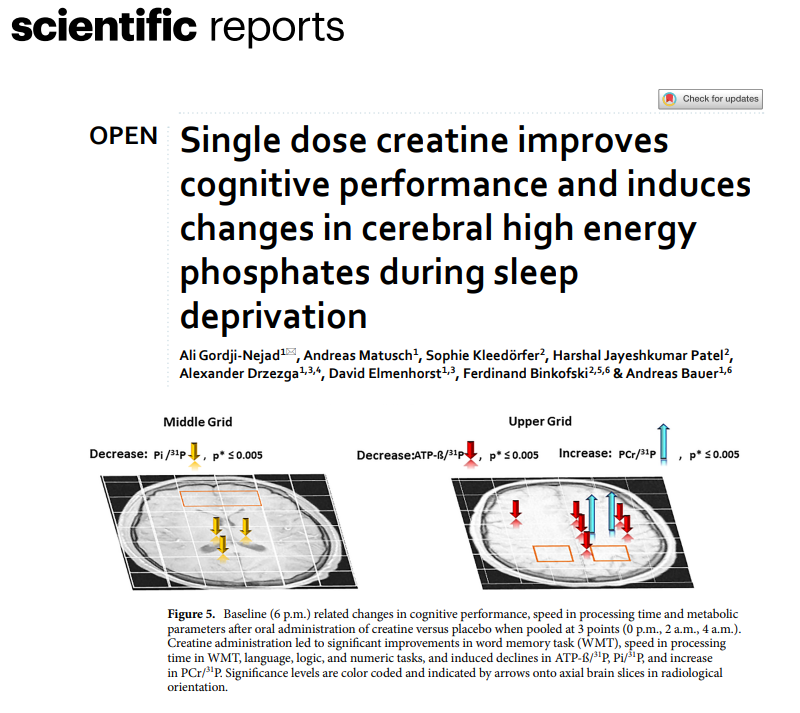 nick_krontiris's tweet photo. Here, a high single dose of creatine monohydrate (0.35 g/kg) appeared to attenuate the negative impact of sleep deprivation on cognitive performance, an effect lasting up to 9 h and showing its maximum cognitive effect at 4 h after oral administration. https://t.co/ohqyAZ2alF