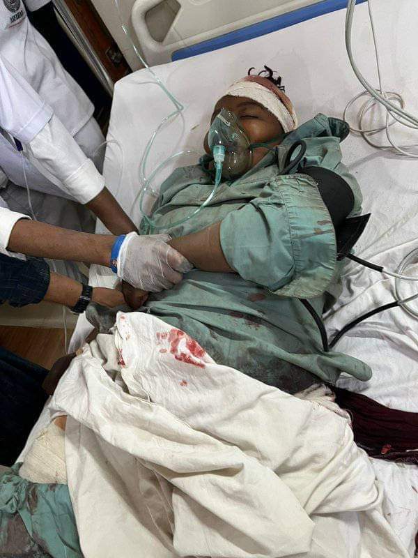 ملاکڙن مان چندوڪري جيجل ماء کي پيٽ گزرر لاء پيسا ڏيندڙ چمبڙ جي ڳوٺ نصير لغاري جو مشھور ٽڪ ٽاڪر علي حيدر شيدي ھميشھ لاء ھن ظالم سماج کان ھڪ ايڪسيڊنٽ جي بھاني سان ڪاوڙجي ويو