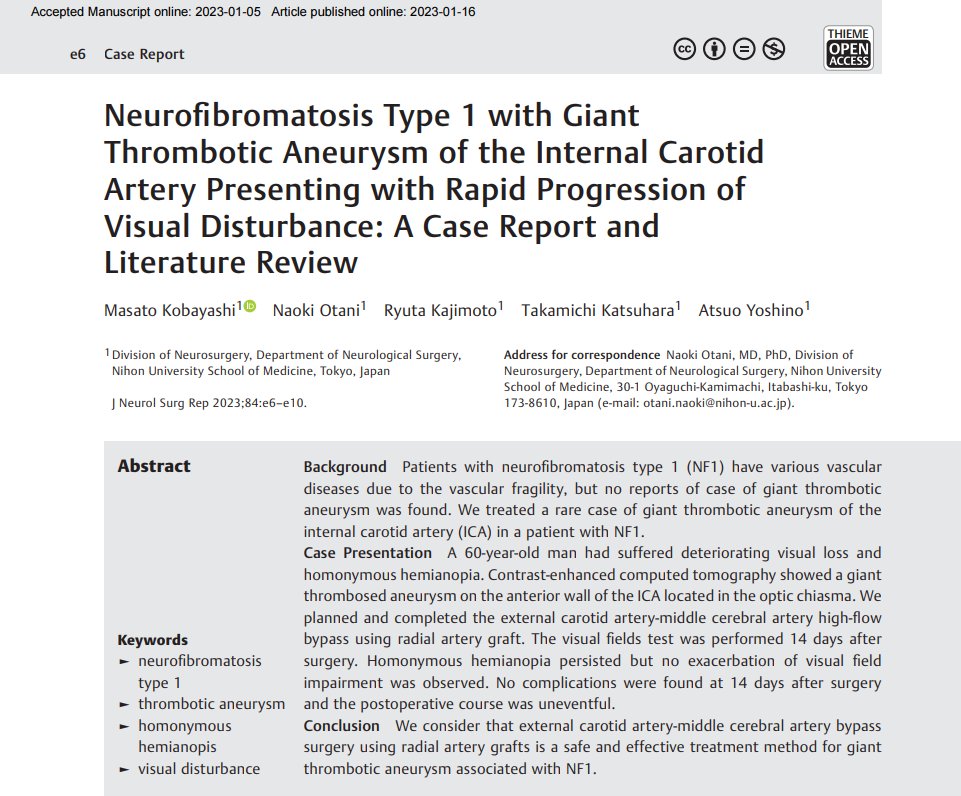 JNLSReports's tweet photo. #OpenAccessSunday
๐ง Read this rare case report about a NF1 patient with a giant thrombotic aneurysm and rapid progression of visual disturbance by M.Kobayashi, et al. !
https://t.co/kvSwMcPFAD
#jnlsreports #skullbase #aneurysm #NF1 #visualdisturbance #neurosurgery https://t.co/Ao3eUiE63o