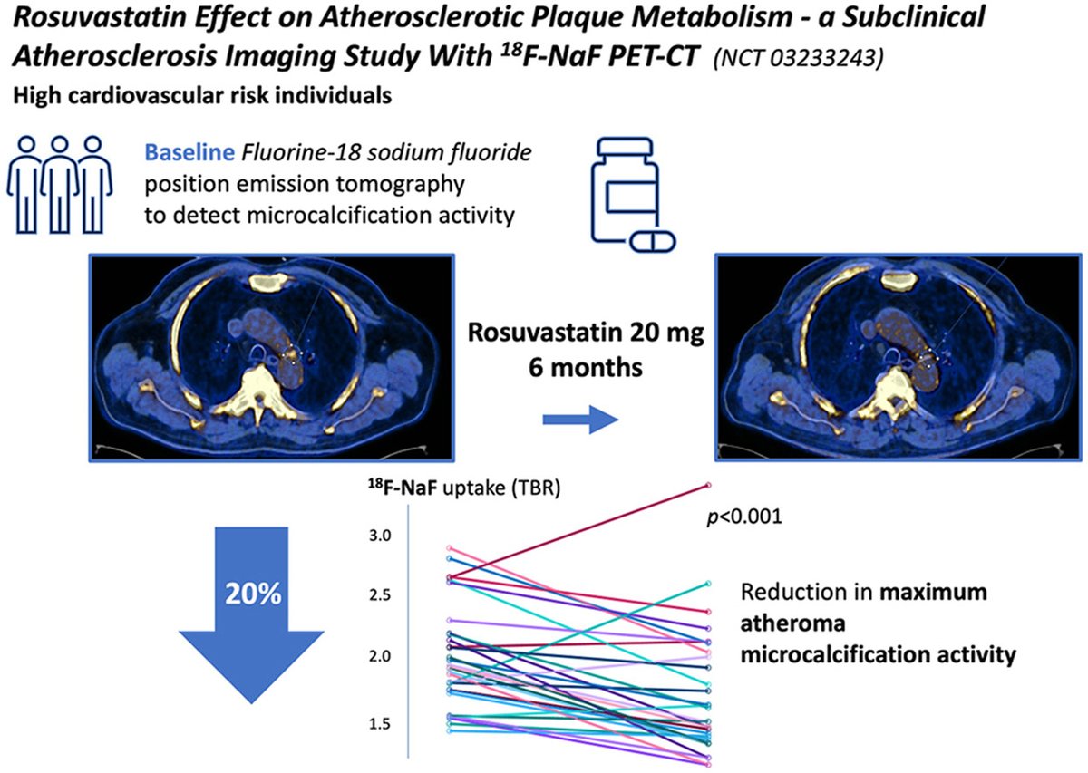 Atheroma microcalcification activity as quantified by 18F–NaF uptake (PET-CT) in individuals w/ subclinical atherosclerosis is significantly reduced after six months of high intensity statin therapy 🔗atherosclerosis-journal.com/article/S0021-… @JoaoBorgesRosa @Piotr_JSlomka @society_eas #CvPrev