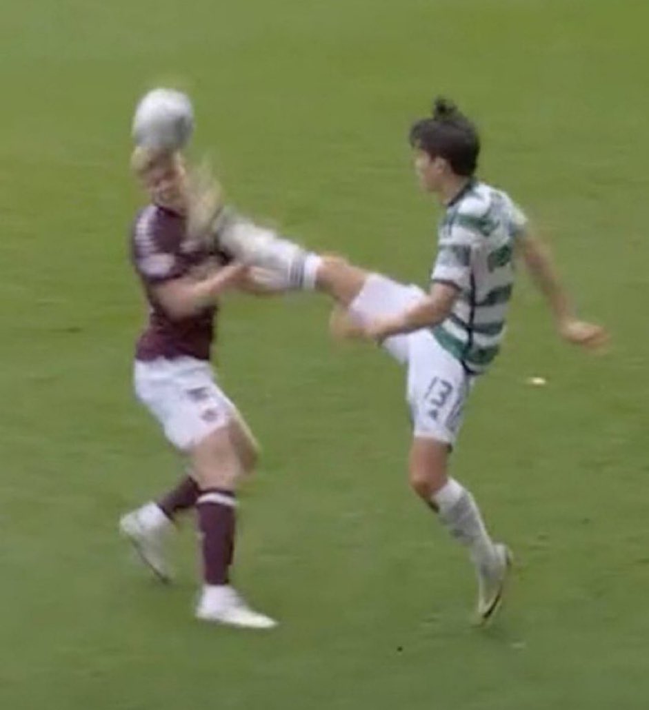1872MB's tweet photo. Only in Scotland would people try and tell you this shouldn’t be a red card 

His studs have made contact with his face 

It is the most blatant Red Card you will ever see 

In the EPL this wouldn’t even be debated😂 https://t.co/k1EfRg538g